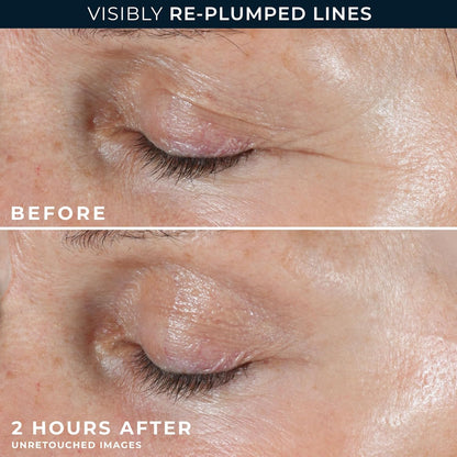 Korean Micro-needling Eye Patches
